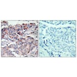 Immunohistochemistry - Anti-JAK2 (phospho Tyr221) Antibody (A7127) - Antibodies.com