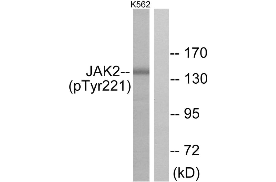 Western Blot - Anti-JAK2 (phospho Tyr221) Antibody (A7127) - Antibodies.com