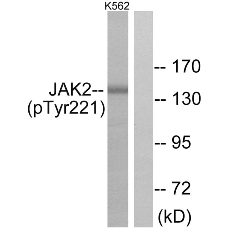 Western Blot - Anti-JAK2 (phospho Tyr221) Antibody (A7127) - Antibodies.com