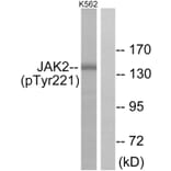 Western Blot - Anti-JAK2 (phospho Tyr221) Antibody (A7127) - Antibodies.com