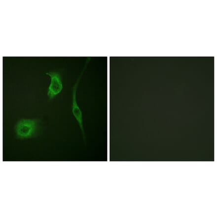 Immunofluorescence - Anti-HSP20 (phospho Ser16) Antibody (A0488) - Antibodies.com