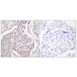 Immunohistochemistry - Anti-HSP20 (phospho Ser16) Antibody (A0488) - Antibodies.com