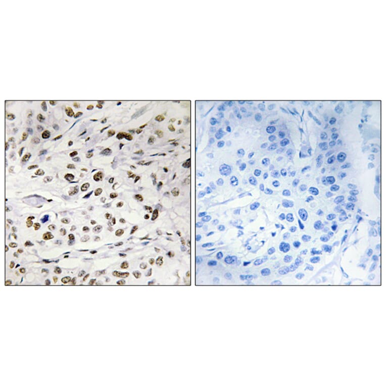 Immunohistochemistry - Anti-HMG14 (phospho Ser21) Antibody (A1040) - Antibodies.com