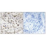 Immunohistochemistry - Anti-HMG14 (phospho Ser21) Antibody (A1040) - Antibodies.com