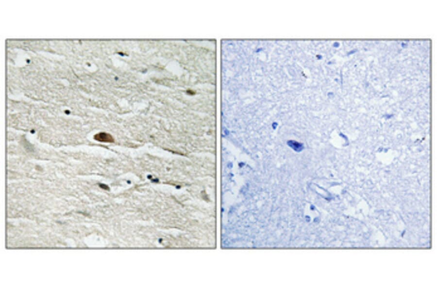 Immunohistochemistry - Anti-HMG14 (phospho Ser21) Antibody (A1040) - Antibodies.com