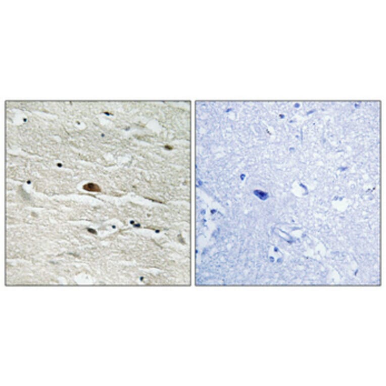 Immunohistochemistry - Anti-HMG14 (phospho Ser21) Antibody (A1040) - Antibodies.com