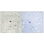 Immunohistochemistry - Anti-HMG14 (phospho Ser21) Antibody (A1040) - Antibodies.com