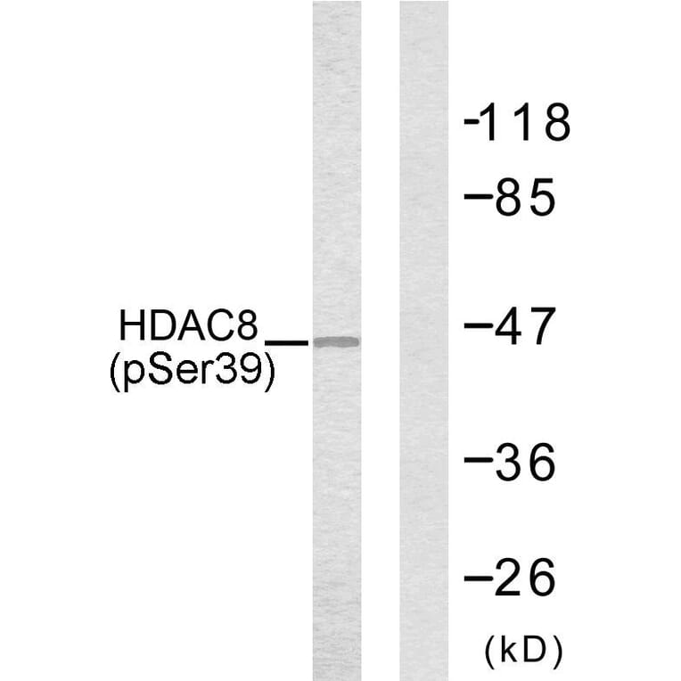 Western Blot - Anti-HDAC8 (phospho Ser39) Antibody (A7102) - Antibodies.com