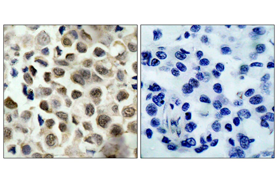 Immunohistochemistry - Anti-HDAC8 (phospho Ser39) Antibody (A7102) - Antibodies.com
