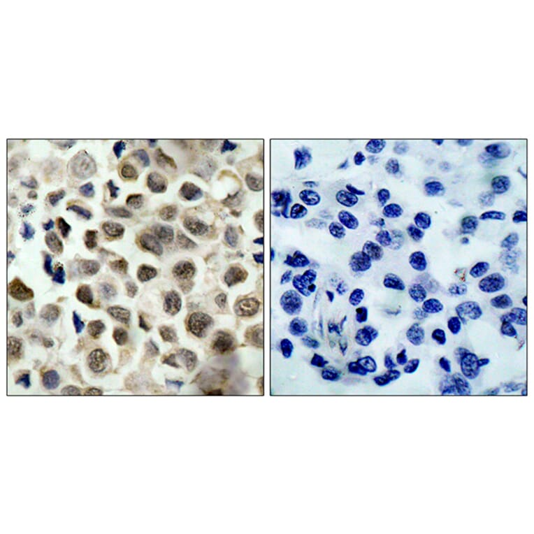 Immunohistochemistry - Anti-HDAC8 (phospho Ser39) Antibody (A7102) - Antibodies.com