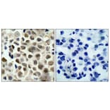 Immunohistochemistry - Anti-HDAC8 (phospho Ser39) Antibody (A7102) - Antibodies.com