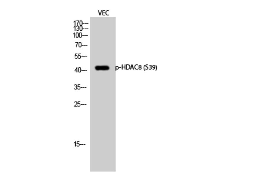 Western Blot - Anti-HDAC8 (phospho Ser39) Antibody (A7102) - Antibodies.com