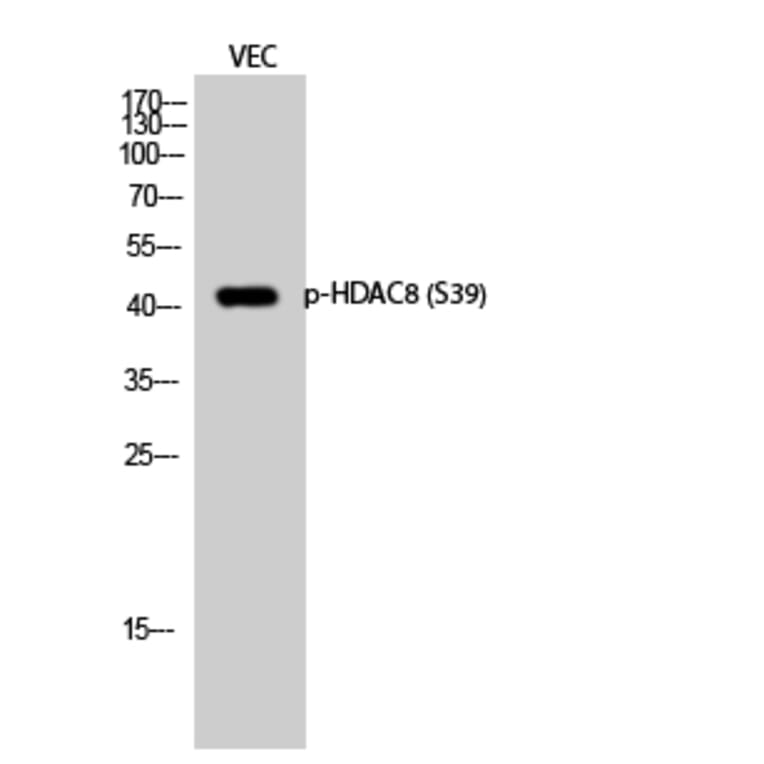 Western Blot - Anti-HDAC8 (phospho Ser39) Antibody (A7102) - Antibodies.com