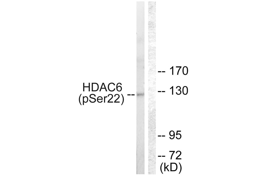 Western Blot - Anti-HDAC6 (phospho Ser22) Antibody (A0941) - Antibodies.com