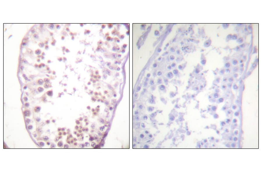 Immunohistochemistry - Anti-HDAC6 (phospho Ser22) Antibody (A0941) - Antibodies.com