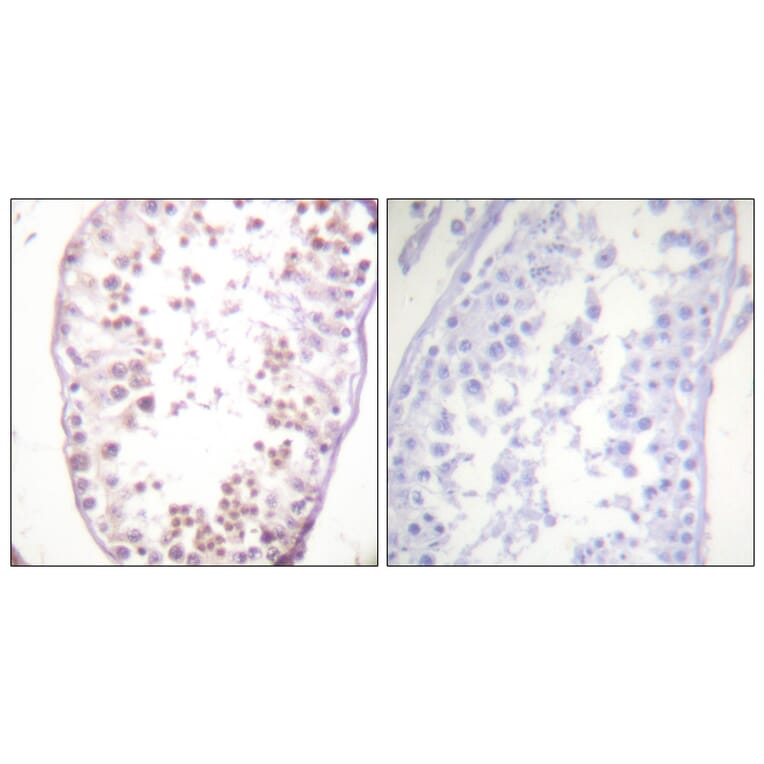 Immunohistochemistry - Anti-HDAC6 (phospho Ser22) Antibody (A0941) - Antibodies.com