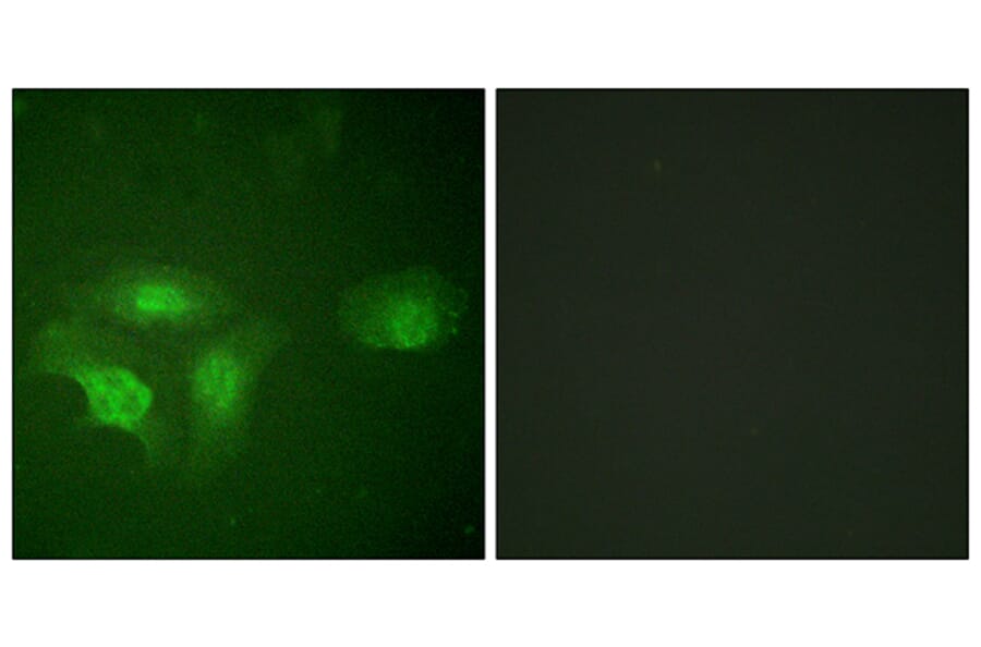 Immunofluorescence - Anti-HDAC6 (phospho Ser22) Antibody (A0941) - Antibodies.com