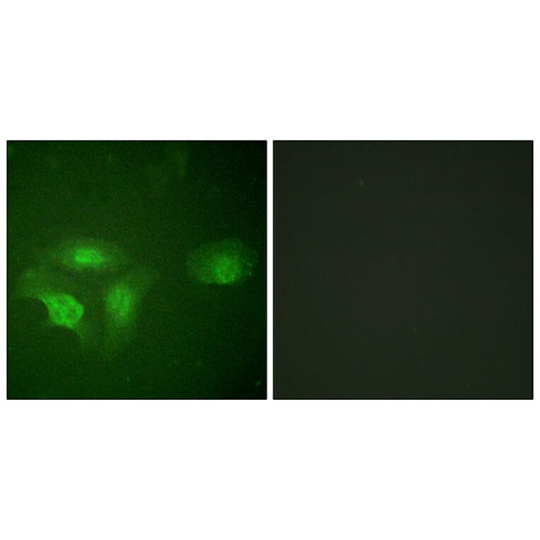 Immunofluorescence - Anti-HDAC6 (phospho Ser22) Antibody (A0941) - Antibodies.com