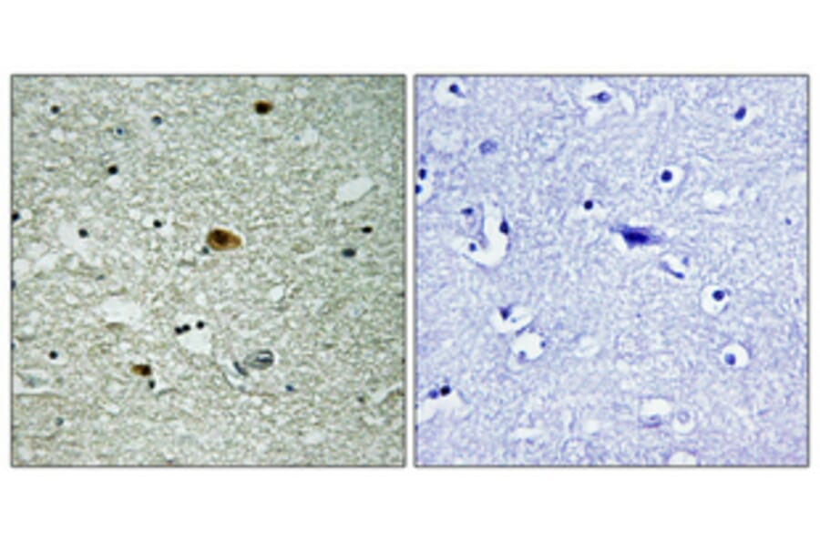 Immunohistochemistry - Anti-HDAC6 (phospho Ser22) Antibody (A0941) - Antibodies.com