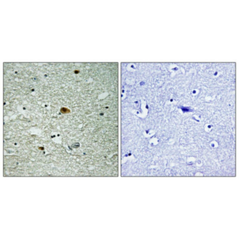 Immunohistochemistry - Anti-HDAC6 (phospho Ser22) Antibody (A0941) - Antibodies.com