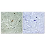 Immunohistochemistry - Anti-HDAC6 (phospho Ser22) Antibody (A0941) - Antibodies.com