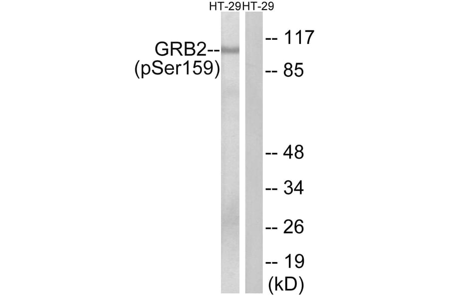 Western Blot - Anti-GRB2 (phospho Ser159) Antibody (A8241) - Antibodies.com