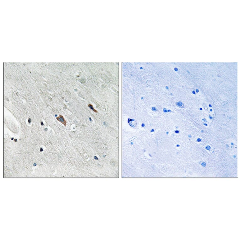 Immunohistochemistry - Anti-Gab2 (phospho Tyr643) Antibody (A8349) - Antibodies.com