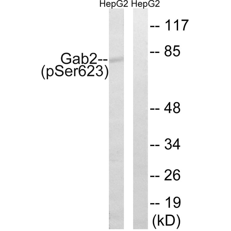 Western Blot - Anti-Gab2 (phospho Ser623) Antibody (A8350) - Antibodies.com