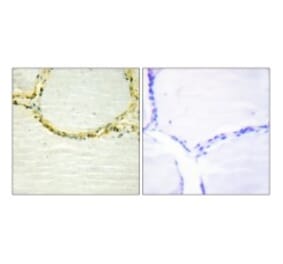 Western Blot - Anti-GAB1 (phospho Tyr659) Antibody (A0788) - Antibodies.com
