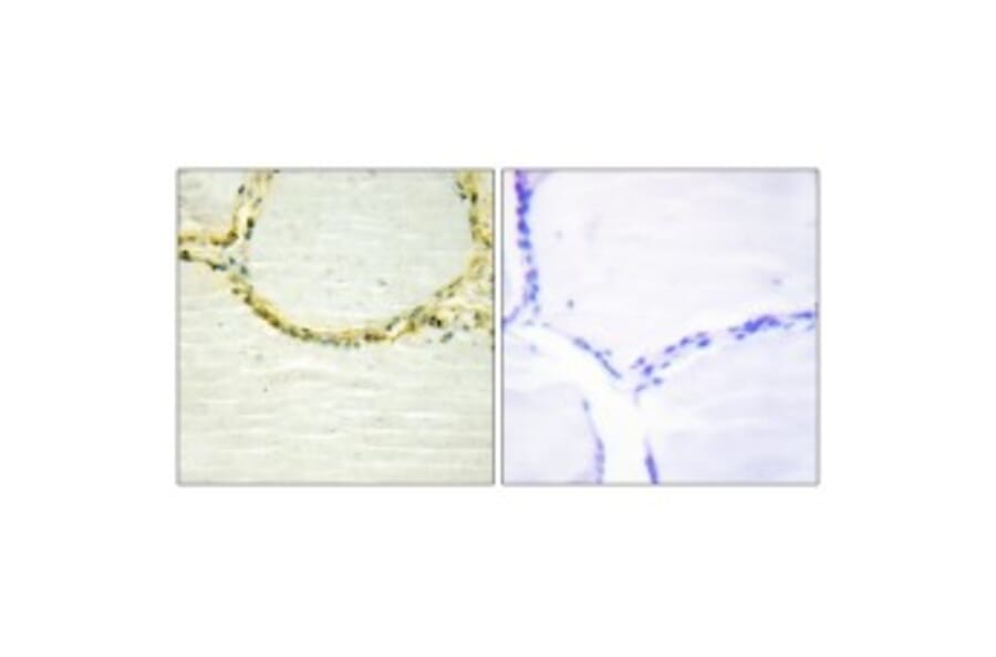 Western Blot - Anti-GAB1 (phospho Tyr659) Antibody (A0788) - Antibodies.com