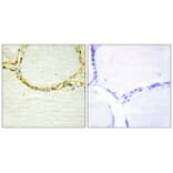 Western Blot - Anti-GAB1 (phospho Tyr659) Antibody (A0788) - Antibodies.com
