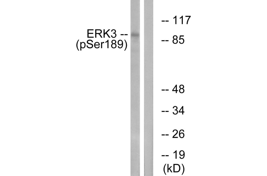 Western Blot - Anti-ERK3 (phospho Ser189) Antibody (A0919) - Antibodies.com
