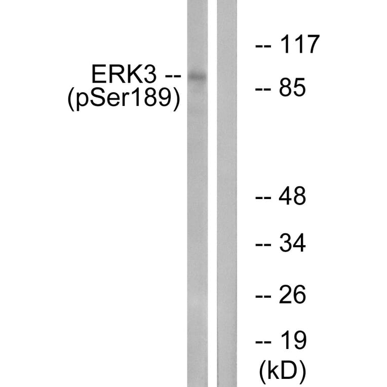 Western Blot - Anti-ERK3 (phospho Ser189) Antibody (A0919) - Antibodies.com