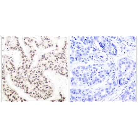 Immunohistochemistry - Anti-Elk1 (phospho Thr417) Antibody (A7070) - Antibodies.com