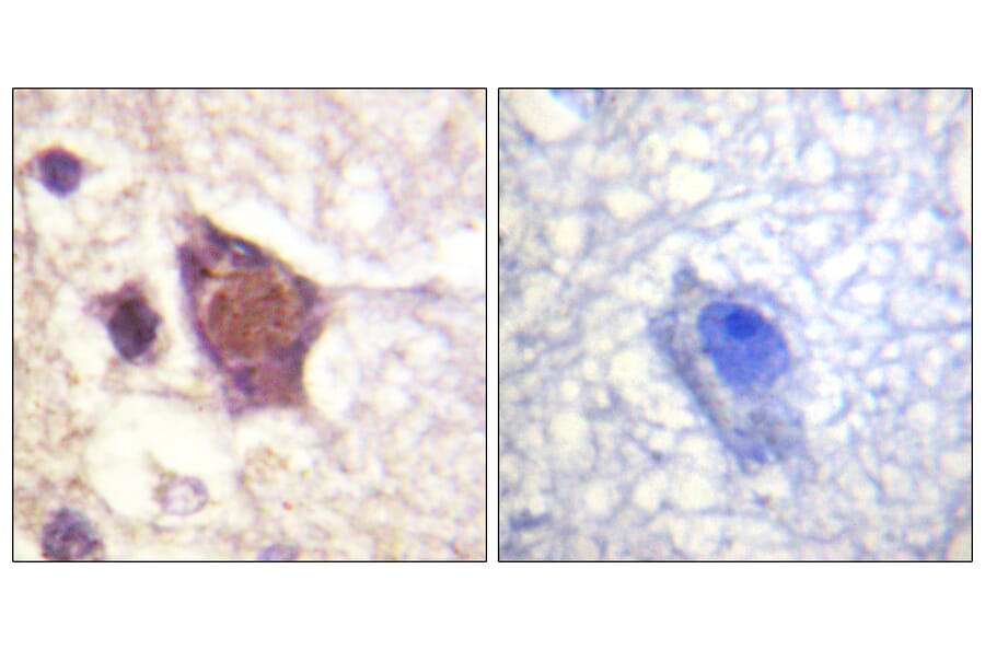 Immunohistochemistry - Anti-DDX3 (phospho Thr322) Antibody (A0902) - Antibodies.com