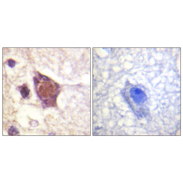 Immunohistochemistry - Anti-DDX3 (phospho Thr322) Antibody (A0902) - Antibodies.com