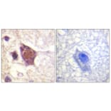 Immunohistochemistry - Anti-DDX3 (phospho Thr322) Antibody (A0902) - Antibodies.com