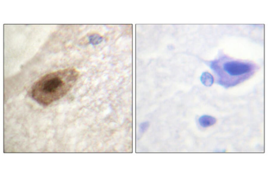 Immunohistochemistry - Anti-DDX3 (phospho Thr322) Antibody (A0902) - Antibodies.com
