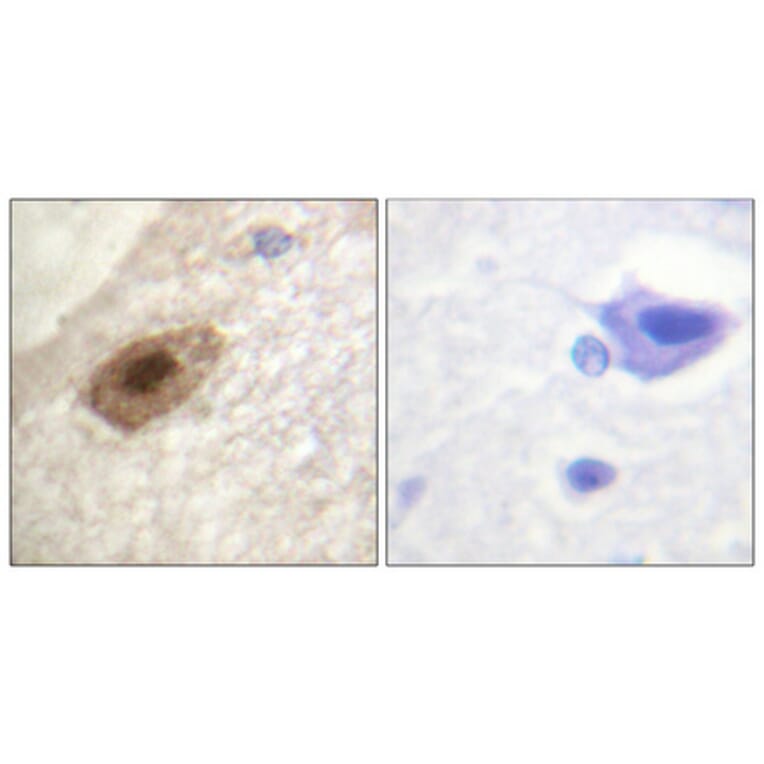 Immunohistochemistry - Anti-DDX3 (phospho Thr322) Antibody (A0902) - Antibodies.com