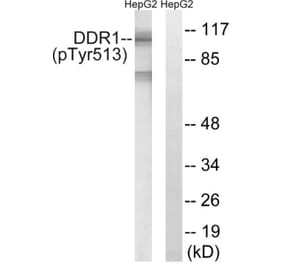 Western Blot - Anti-DDR1 (phospho Tyr513) Antibody (A8240) - Antibodies.com