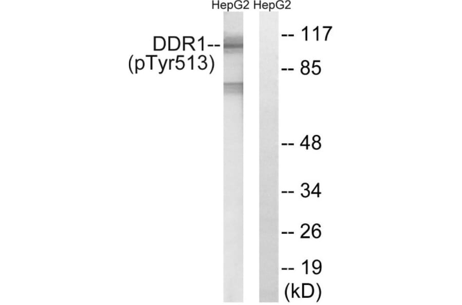 Western Blot - Anti-DDR1 (phospho Tyr513) Antibody (A8240) - Antibodies.com