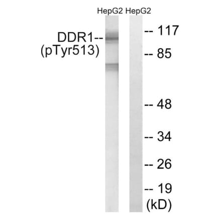 Western Blot - Anti-DDR1 (phospho Tyr513) Antibody (A8240) - Antibodies.com