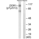 Western Blot - Anti-DDR1 (phospho Tyr513) Antibody (A8240) - Antibodies.com