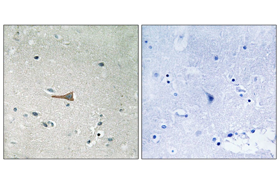 Immunohistochemistry - Anti-DDR1 (phospho Tyr513) Antibody (A8240) - Antibodies.com