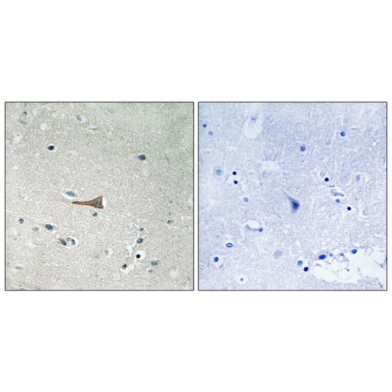 Immunohistochemistry - Anti-DDR1 (phospho Tyr513) Antibody (A8240) - Antibodies.com