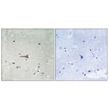 Immunohistochemistry - Anti-DDR1 (phospho Tyr513) Antibody (A8240) - Antibodies.com