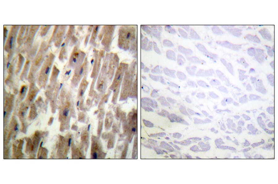 Immunohistochemistry - Anti-CRYAB (phospho Ser45) Antibody (A0896) - Antibodies.com