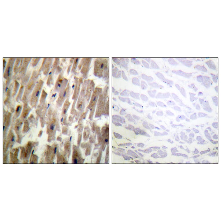 Immunohistochemistry - Anti-CRYAB (phospho Ser45) Antibody (A0896) - Antibodies.com