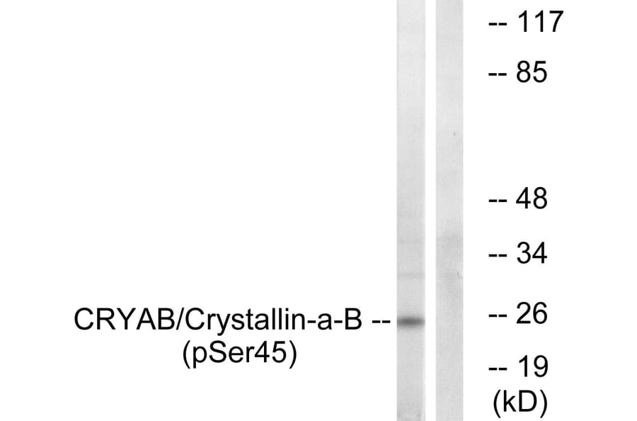 Western Blot - Anti-CRYAB (phospho Ser45) Antibody (A0896) - Antibodies.com