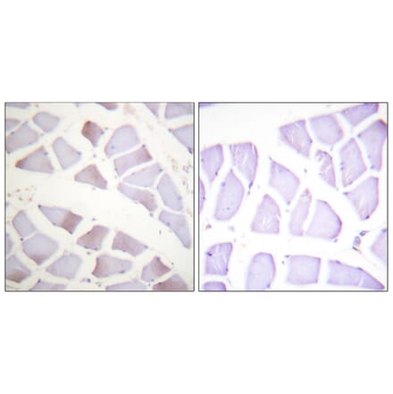 Immunohistochemistry - Anti-CRYAB (phospho Ser19) Antibody (A0895) - Antibodies.com